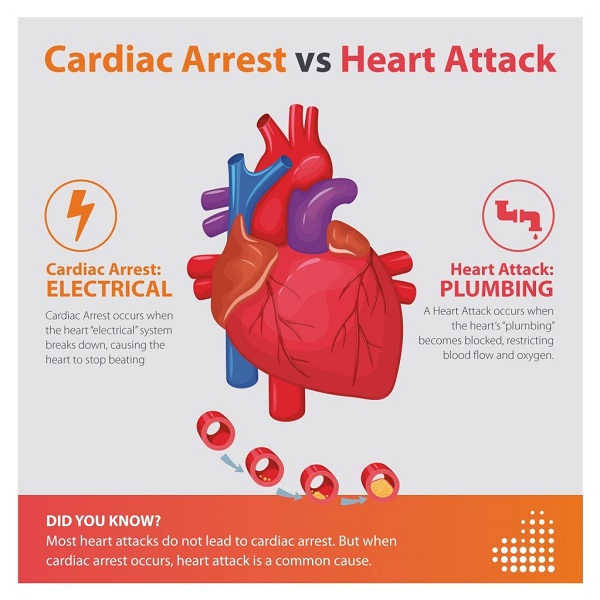 Cardiac Nursing Homework Help