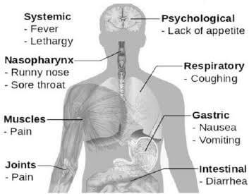 influenza symptoms